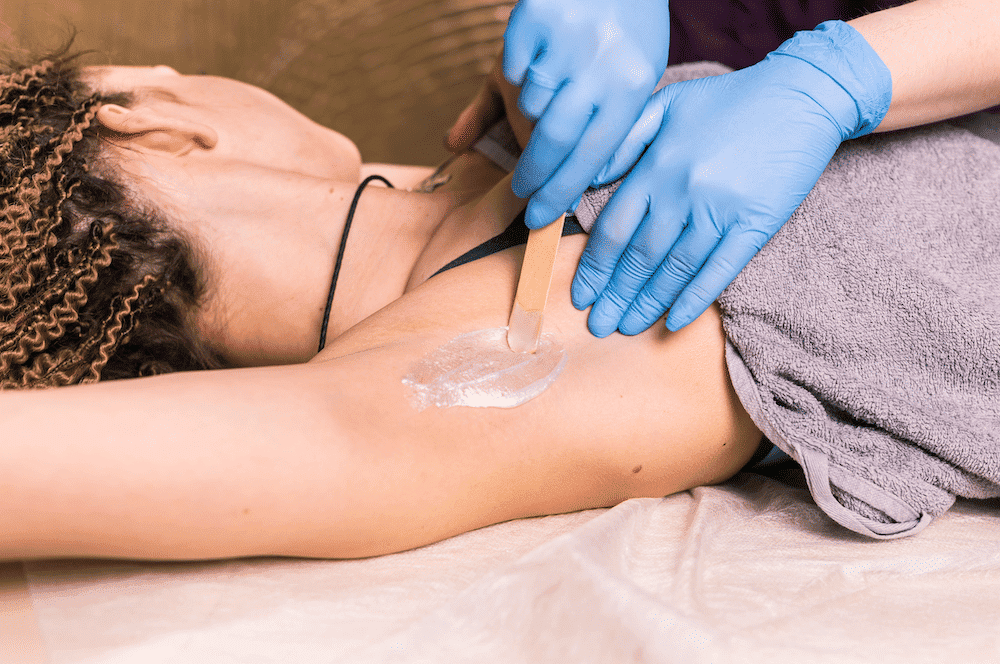 Aesthetician applying wax on woman's underarm for hair removal.